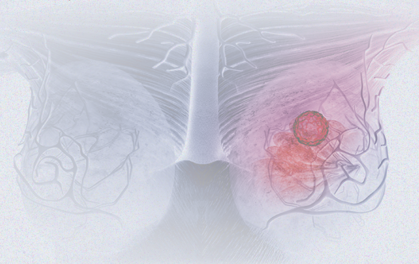 國際婦女節(jié) | 關(guān)注乳腺癌 微創(chuàng)介入讓美麗繼續(xù)，「乳」愿以償正成為現(xiàn)實(shí)